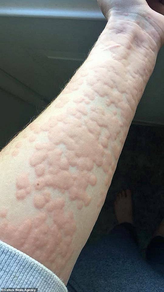 3分19秒砍断手断脚视频