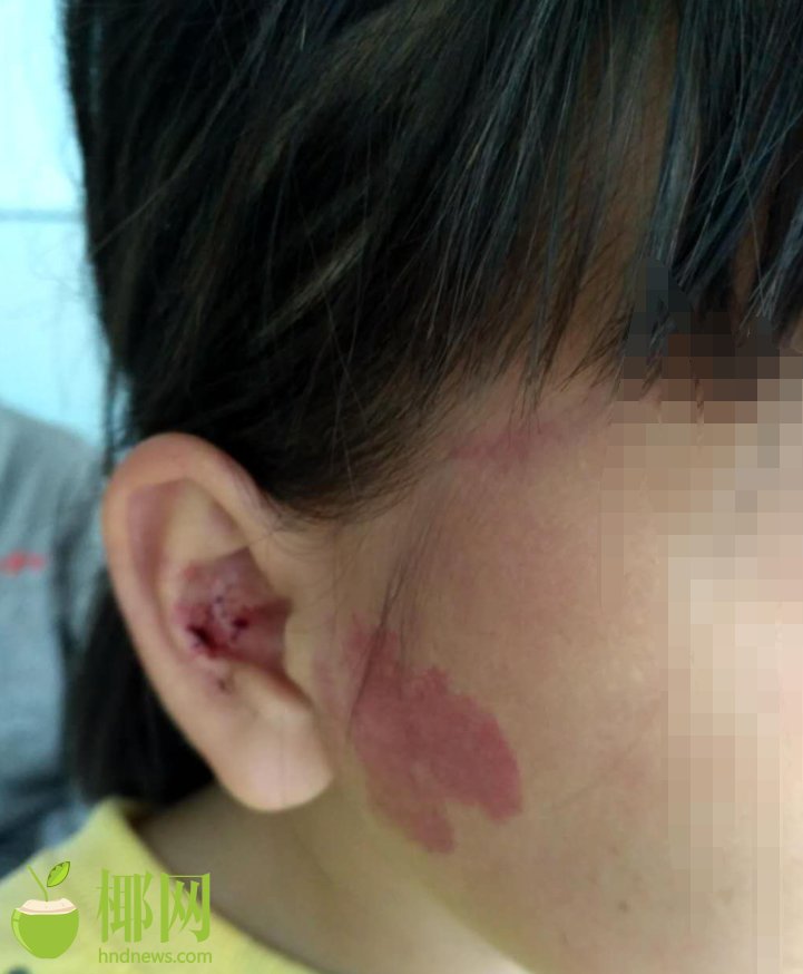 女人趴下脱了内裤光着打屁股