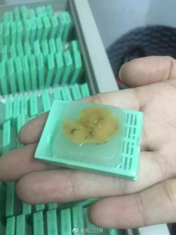 視訊流出