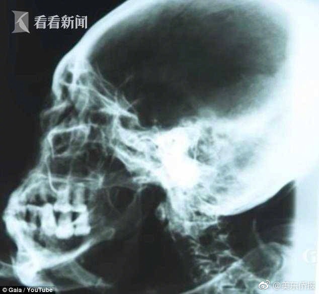 刘玥单挑三黑是哪一集