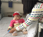 華中最小患兒肝移植成功