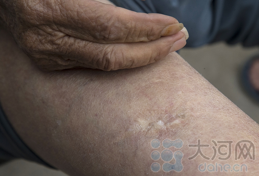 寻找抗战老兵:王作电身带46块弹片的坚强老兵