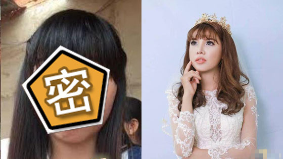 女子太丑没人肯娶 花10万整容后嫁了富二代