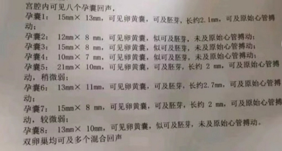 改变想法了河南女子怀上八胞胎打算留1到2个孕囊