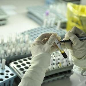 【艾滋病有望治愈?英国科学家研究新疗法初.