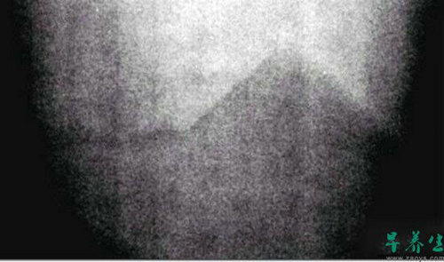 9. 这是阿波罗7号于1972年12月拍下的照片,当时他们在前往月球的飞行路上。当初NASA认为这张照片是空白的,但是经过调整照片的对比度后可看到有个类似金字塔形状的建筑。NASA至今再也未对此张照片做过评论。