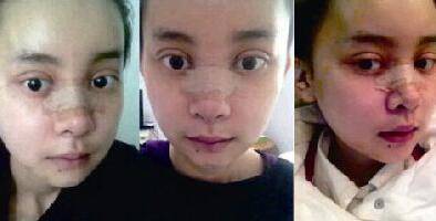 女子花百万整成Baby 变脸日记爆红