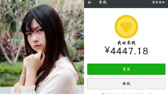 GNZ48杜秋霖爸爸被烧伤 筹到90.2万医疗费
