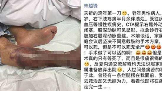 医生苦劝患者截肢 家人:人可以死,但不能死无全尸