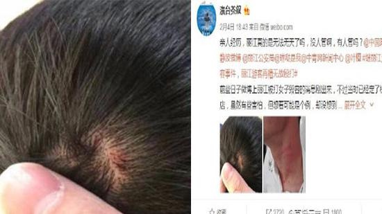 丽江游客餐厅催饭被辱骂 报警后再遭店员暴打尾随