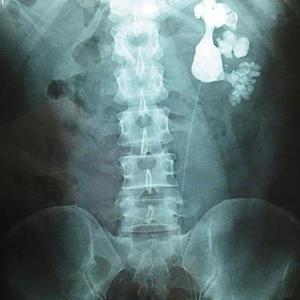 6a5ce645ly1ffvmfz5eebj20m80psjsz