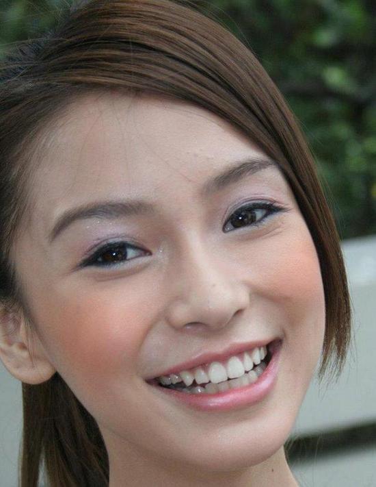 有人肯定好奇为什么明星们都是双眼皮,还要贴双眼皮贴?岂不是多此一举?