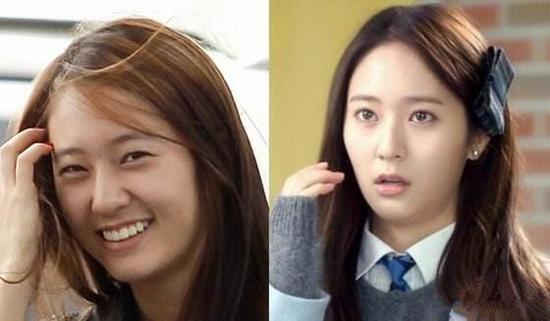 像韩国这样没有双眼皮基因,靠整形改变的国家,在进行双眼皮手术的同时也要进行眼部抽脂。