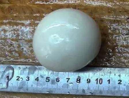 “那个东西在患者腹腔内可以自由移动,没有与任何血管、神经和组织有粘黏,似乎是孤立存在于患者体内,我们一下子就把它取出来了。”医院胃肠外科医生介绍,取出的肿块是椭圆形,外表圆润光滑,颜色淡白色,形似玉石球,更像一个蛋,但表面有弹性