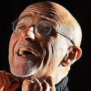 世界首例人体换头术图片