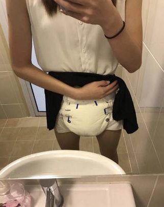 女学生附上她掀起及膝短裙包着尿布的照片,告诉大家新闻说得都是真的,并表示自己接受治疗后,仍不到10分钟就想上厕所;她其实觉得穿尿布不可耻,“可耻的是你继续沉沦在黑暗之中,拉不回来…”