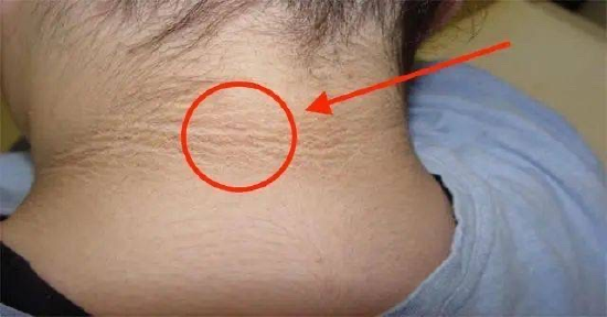 11c6-bf71f9a436482dd13501d2ec13c0acd3.png