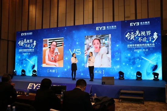 已术员工现场分享摘镜感受