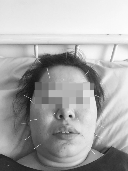 33岁妈和3岁儿农药中毒 疑似吃韭菜盒子惹祸