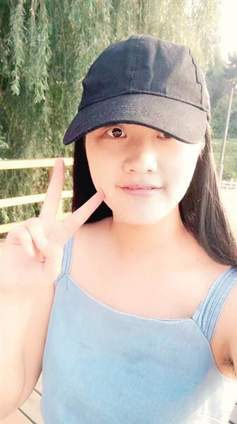 张佳丽