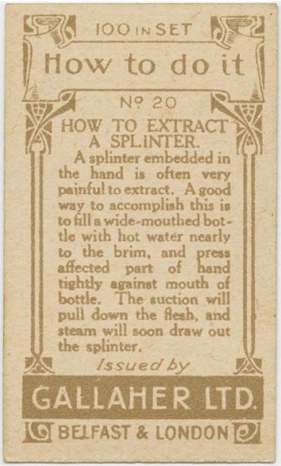 How to Extract a Splinter