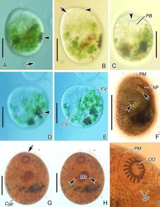 Naxella paralucida 活细胞和染色后标本照片