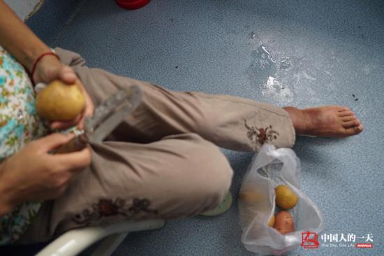 看见阿毛的脚肿的厉害,彭琼雁便削了土豆片,贴在阿毛手脚上帮助消肿,尽管她自己的脚也肿得发黑了。 (来自:中国人的一天)