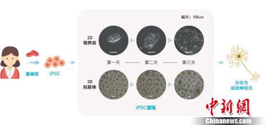 “渐冻症”iPSC原理图。科研人员供图