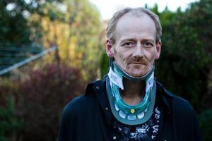 英男子露营坠崖 摔断112根骨头奇迹生还(图)