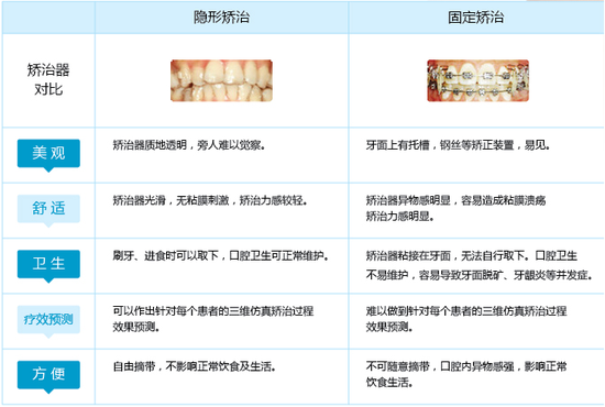 无托槽隐形矫治器