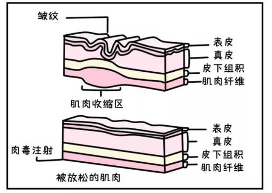 作用原理