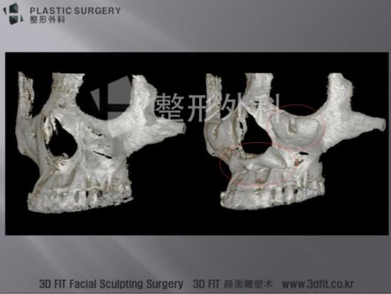 来自白汀桓医生博客