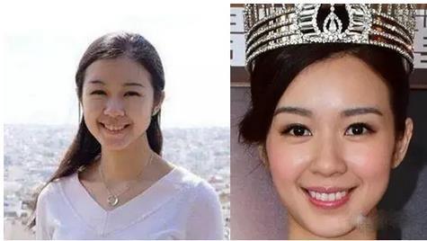 从路人到港姐,只有一个微整形的距离! 从路人到港姐,只有一个微整形的距离!
