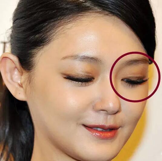 伊能静二胎产女双眼皮抢镜 女星尴尬的双眼皮