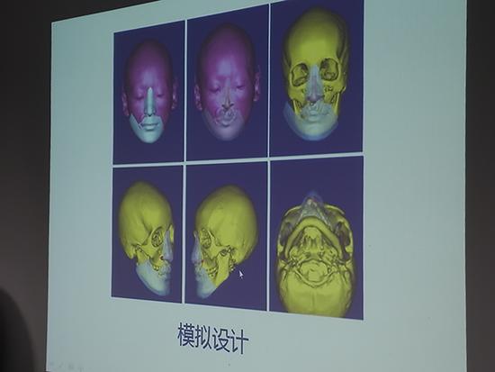  模拟技术方案。 上海第九人民医院 供图