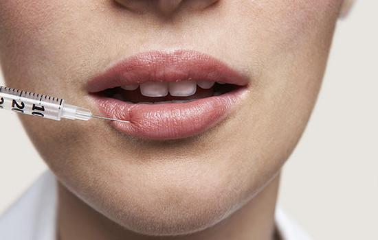 玻尿酸丰唇后不可不知的事?|玻尿酸|丰唇|安吉丽娜-朱莉_新浪女性_新浪网