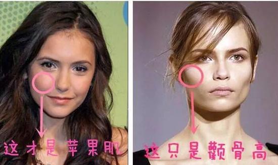 苹果肌到底有多重要?!