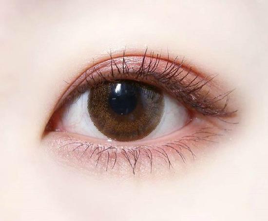 为什么眼疾患者不适合做双眼皮