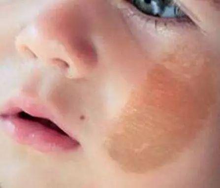 咖啡好喝 咖啡斑不好看