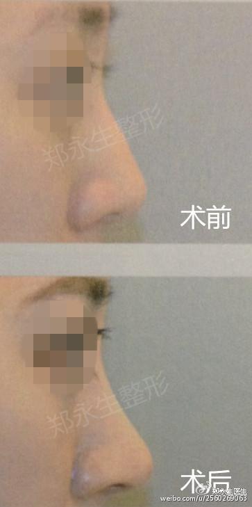 对比
