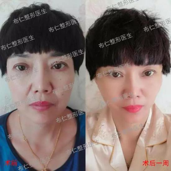 效果对比