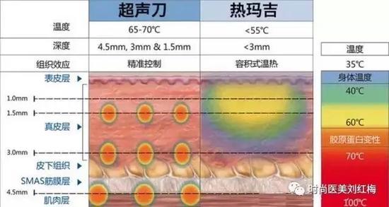 热玛吉