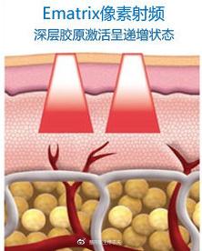 像素射频