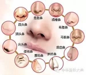 鼻部整形科普篇
