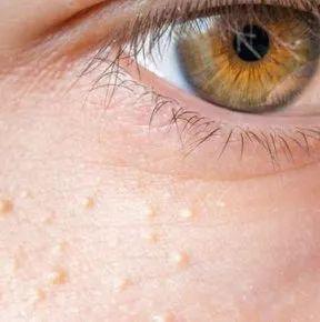 图源:australianskinclinics.com.au