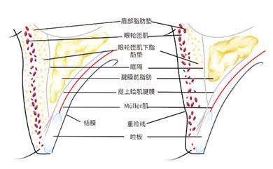 图1 东西方上睑解剖差异