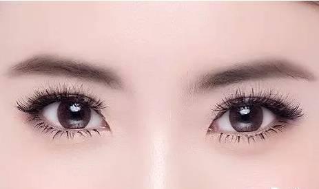 什么是激光双眼皮 做激光双眼皮后要注意什么