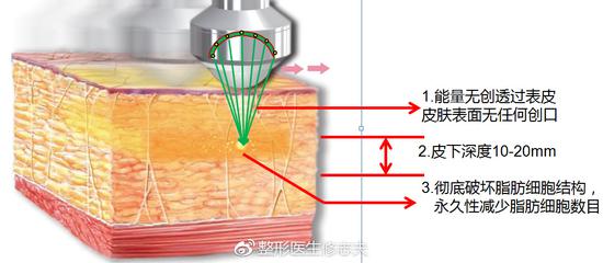 “聚能廋”的效，能分为三个部分