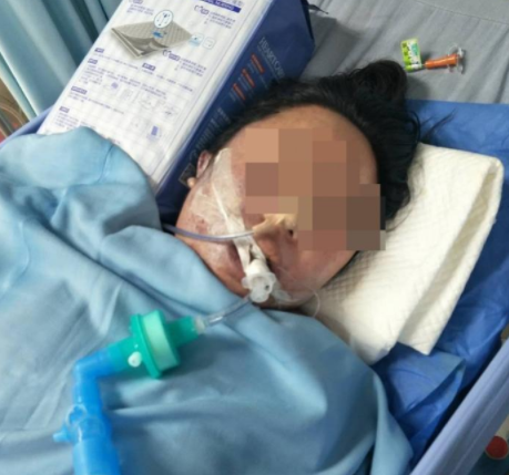 女子做美容手术后不幸身亡