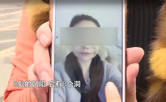 女子脸整容整出8个坑 整形医院这样回应令当事人无法接受